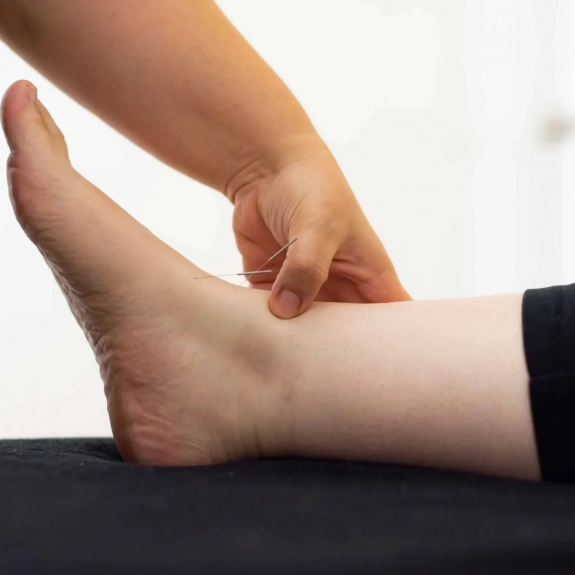Balance Method Acupuncture By Dr Richard Tan
