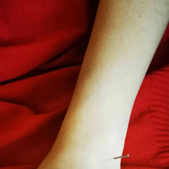 Master Tung's Acupuncture - Acupuncture in Reading, Berkshire and Surrounding Areas - Lina Doyle
